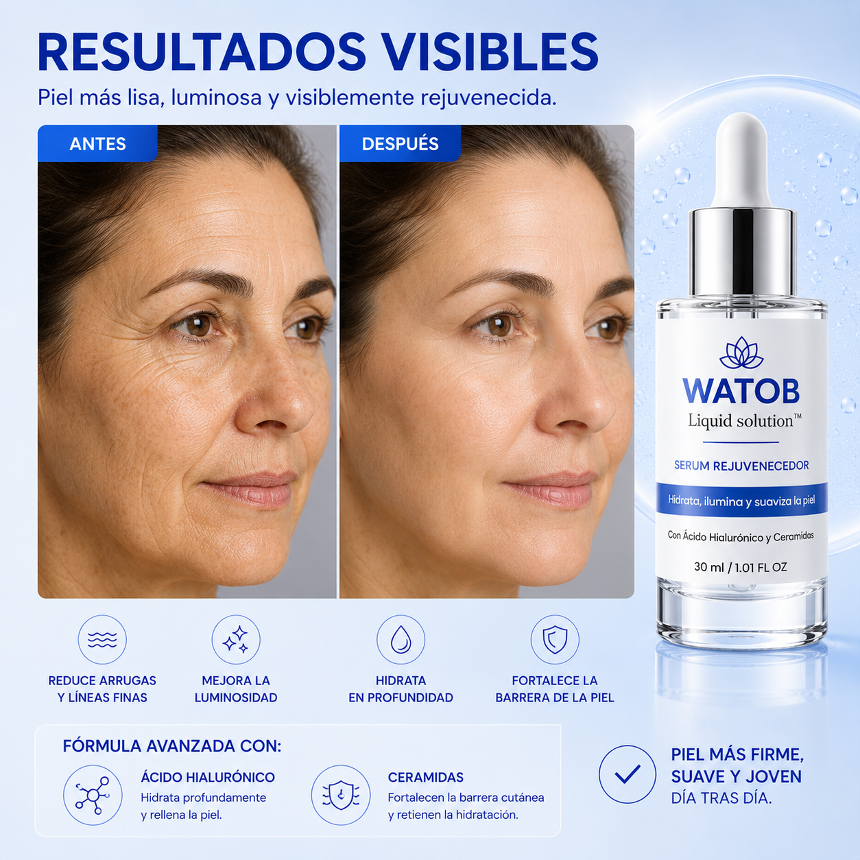 Watob Liquid Solution™ - Hidratación profunda y efecto relleno de larga duración.