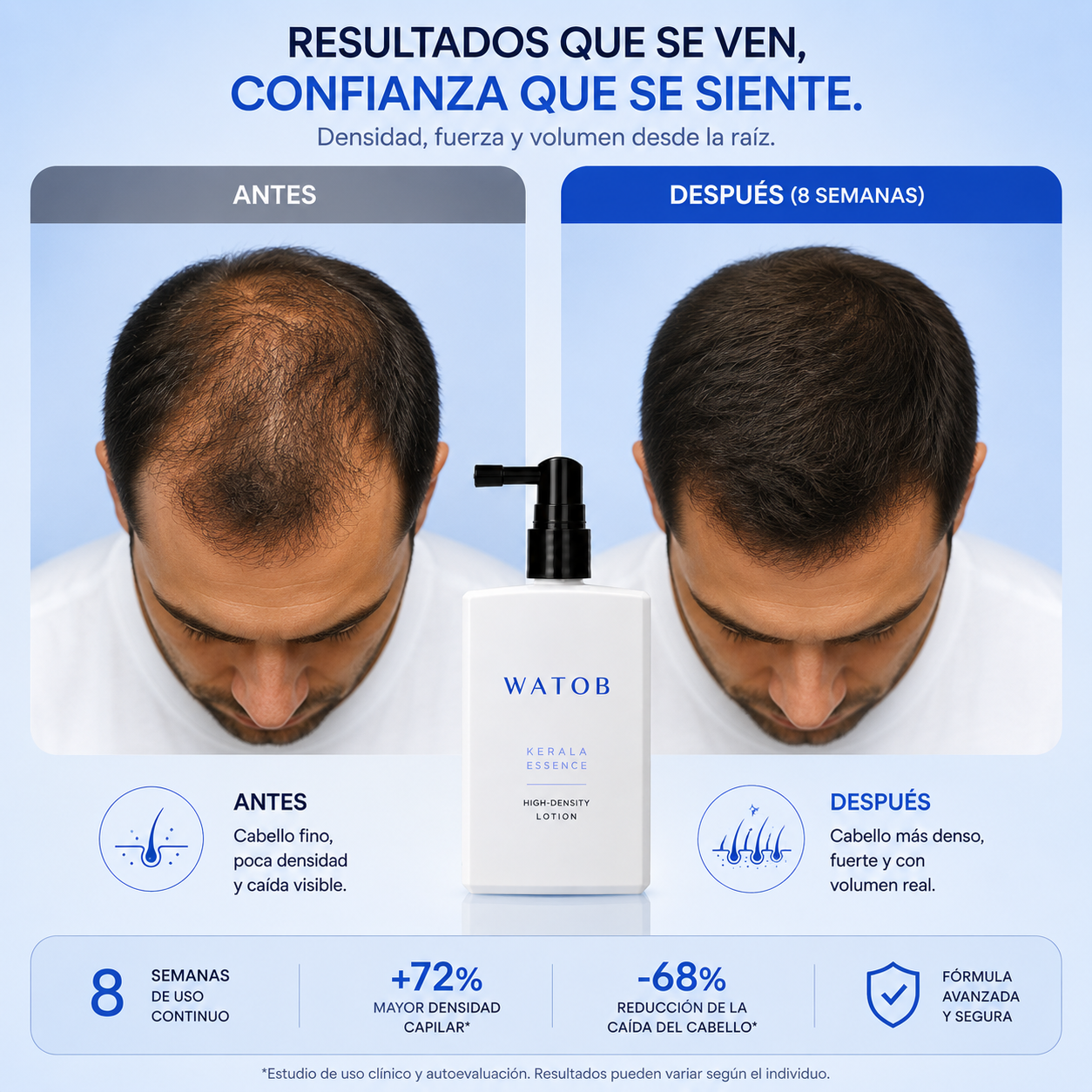 Karala Essence - Loción Anticaída Engrosadora Capilar