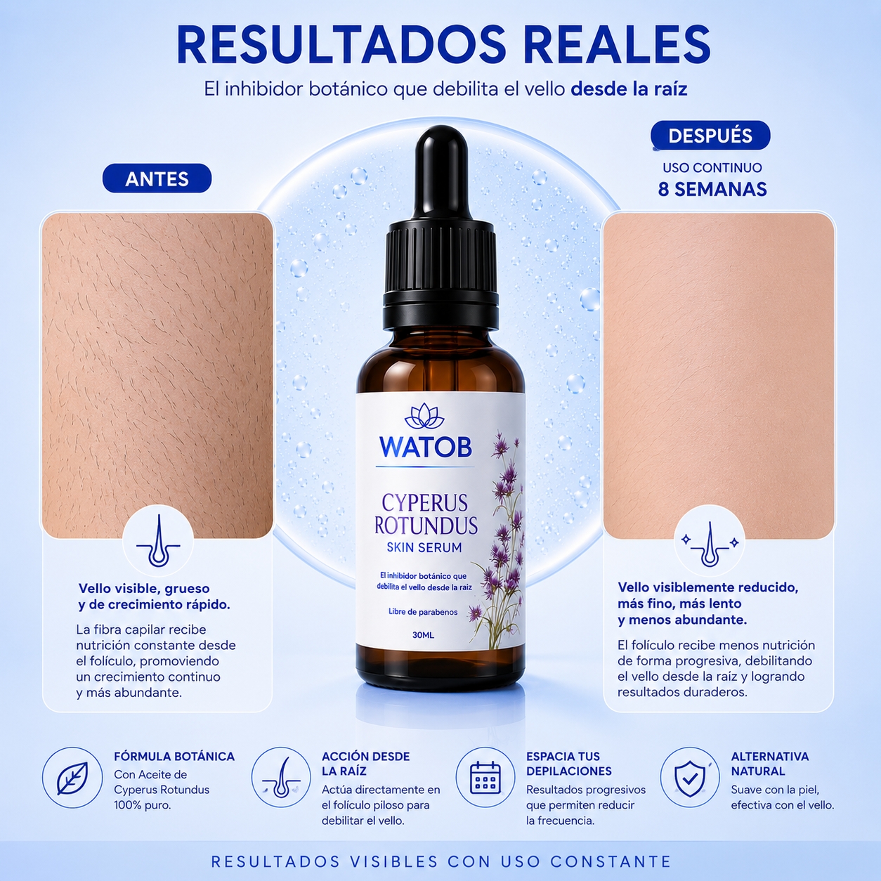 Aceite de Cyperus Rotundus - Dile adiós al vello de forma progresiva y 100% natural
